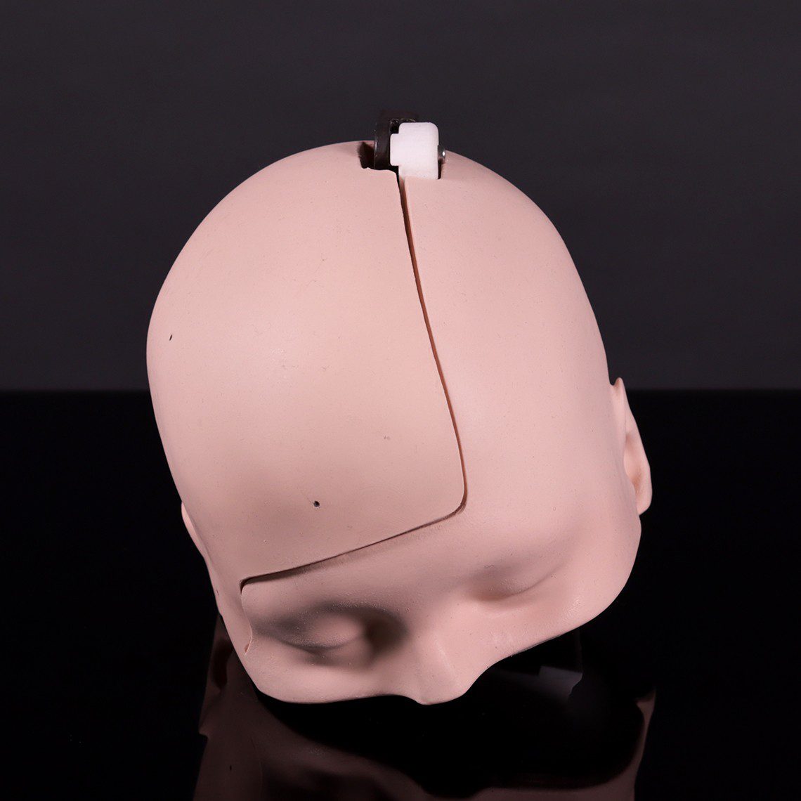 [S-15] PHACON Neuro Patient “Becker” – Skull, muscle